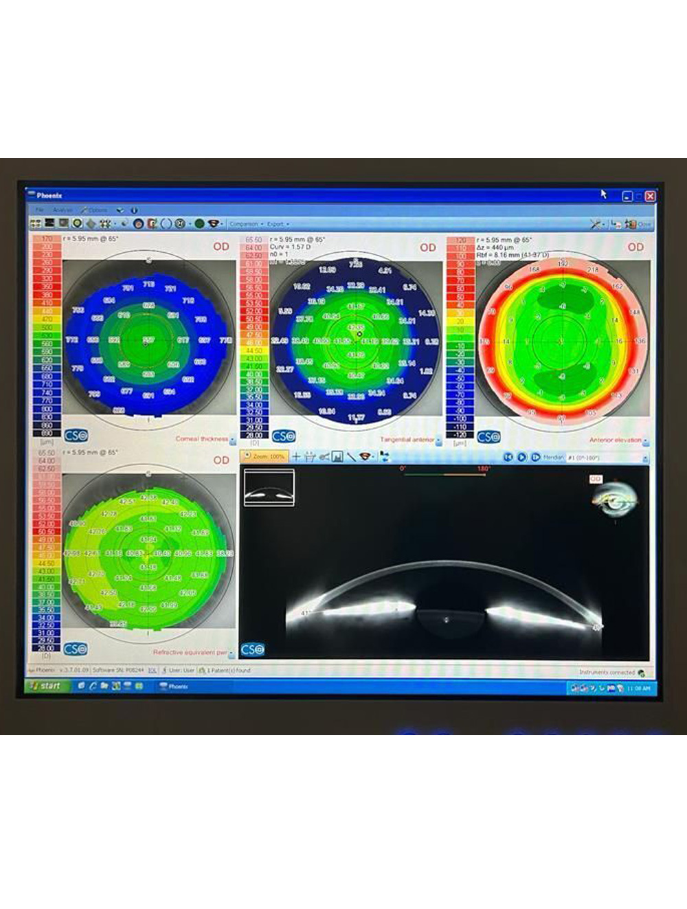 Buy-CSO-Sirius-Topographer