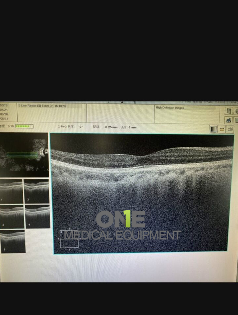 Refurbished-Zeiss-Cirrus-500-HD-OCT