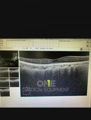 Refurbished-Zeiss-Cirrus-500-HD-OCT
