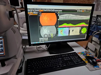 refurbished-topcon-dri-triton-plus-oct-anterior