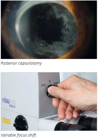 ZEISS-VISULAS-YAG-III-Posterior-capsulotomy-Variable-focus-shift