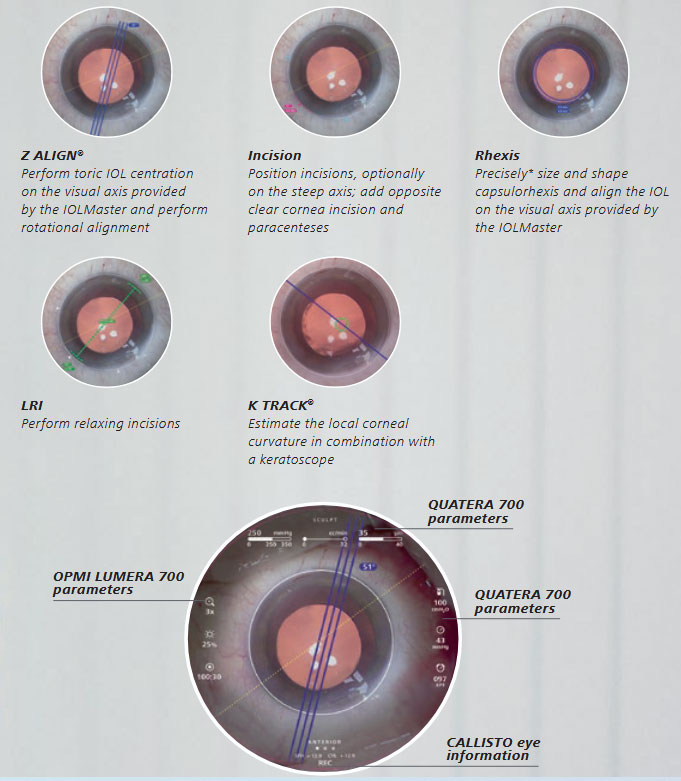 ZEISS_Opmi_Lumera_700_Cataract_Assistance_Functions